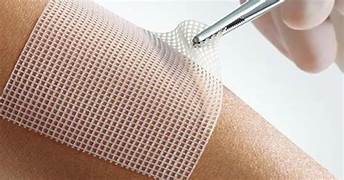 WUNDVERSORGUNG SPEZIAL