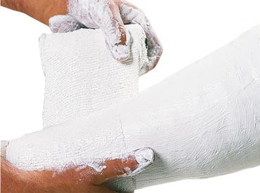 Cellona® Gipslonguette 20 mx 12 cm 1x1 Stück